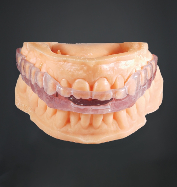 Ferula Michigan - my lab dental